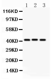 GATA5 antibody Western blot. All lanes: Anti GATA5 at 0.5 ug/ml. Lane 1: Rat Liver Tissue Lysate at 50 ug. Lane 2: Rat Brain Tissue Lysate at 50 ug. Lane 3: Rat Ovary Tissue Lysate at 50 ug. Predicted band size: 42 kD. Observed band size: 42 kD.