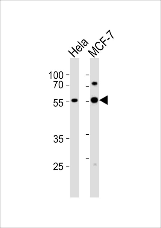 Western blot of lysates from HeLa, MCF-7 cell line (from left to right) with GATA6 Antibody. Antibody was diluted at 1:1000 at each lane. A goat anti-rabbit IgG H&L (HRP) at 1:10000 dilution was used as the secondary antibody. Lysates at 20 ug per lane.