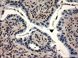Anti-GATA6 mouse monoclonal antibody immunofluorescent staining of COS7 cells transiently transfected by pCMV6-ENTRY GATA6.