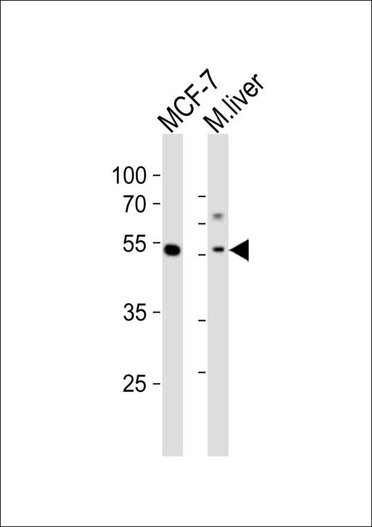 Western blot of lysates from MCF-7 cell line, mouse liver tissue lysate (from left to right) with Gata6 Antibody. Antibody was diluted at 1:1000 at each lane. A goat anti-rabbit IgG H&L (HRP) at 1:10000 dilution was used as the secondary antibody. Lysates at 20 ug per lane.