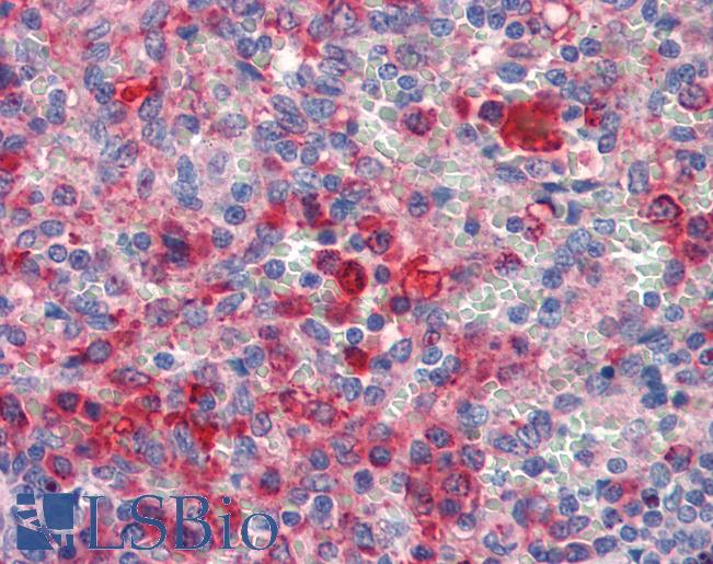 Anti-GATA6 antibody IHC of human spleen. Immunohistochemistry of formalin-fixed, paraffin-embedded tissue after heat-induced antigen retrieval. Antibody LS-B3483 concentration 5 ug/ml.