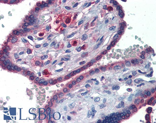 Anti-GATA6 antibody IHC of human placenta. Immunohistochemistry of formalin-fixed, paraffin-embedded tissue after heat-induced antigen retrieval. Antibody LS-B3483 concentration 5 ug/ml.