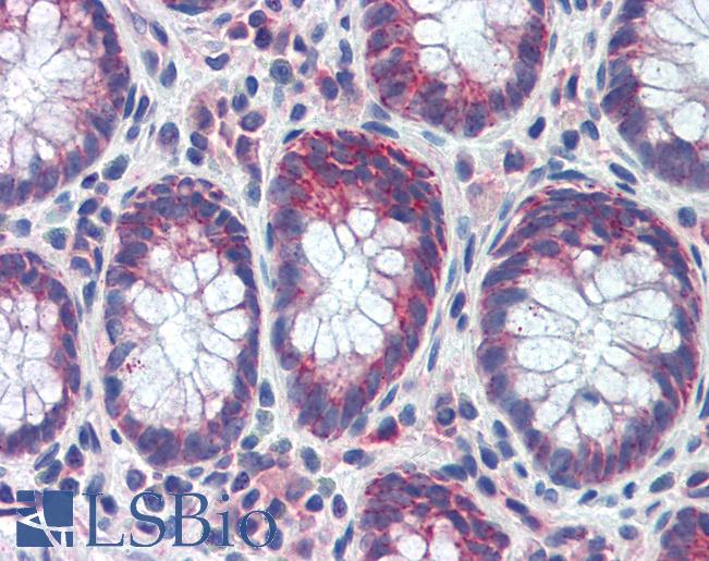 Anti-GATA6 antibody IHC of human colon. Immunohistochemistry of formalin-fixed, paraffin-embedded tissue after heat-induced antigen retrieval. Antibody LS-B3483 concentration 5 ug/ml.