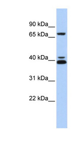 GATA6 antibody LS-B3483 Western blot of MCF7 cell lysate.