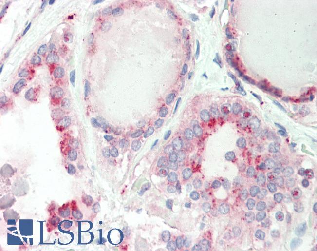 Haman, Thyroid: Foramlin-Fixed Paraffin-Embedded (FFPE)