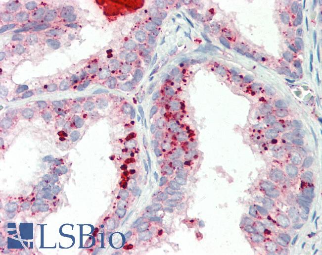 Human, Prostate: Formalin-Fixed Paraffin-Embedded (FFPE)