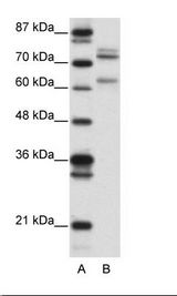 A: Marker, B: 293T Cell Lysate