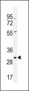 COPE Antibody western blot of A375 cell line lysates (35 ug/lane). The COPE antibody detected the COPE protein (arrow).