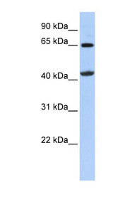 GATM antibody LS-C102306 Western blot of 721_B cell lysate.