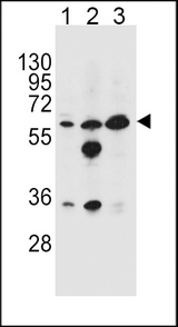 GATM Antibody western blot of HL-60(lane 1),MDA-MB453(lane 2),K562(lane 3) cell line lysates (35 ug/lane). The GATM antibody detected the GATM protein (arrow).