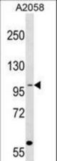 COPG Antibody western blot of A2058 cell line lysates (35 ug/lane). The COPG antibody detected the COPG protein (arrow).