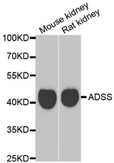 Western blot analysis of extracts of various cell lines, using GATM antibody.