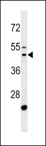 GATSL1 Antibody western blot of MDA-MB231 cell line lysates (35 ug/lane). The GATSL1 antibody detected the GATSL1 protein (arrow).