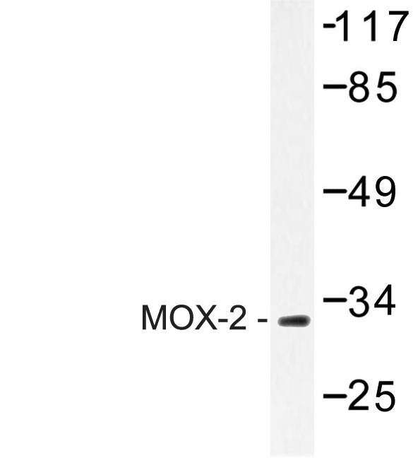 Western blot of MOX-2 (N184) pAb in extracts from COLO205 cells.