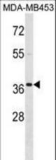 MEOX2 Antibody western blot of MDA-MB453 cell line lysates (35 ug/lane). The MEOX2 Antibody detected the MEOX2 protein (arrow).