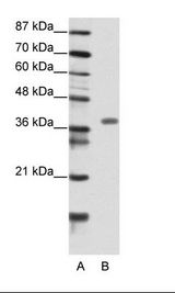 A: Marker, B: Transfected 293T Cell Lysate