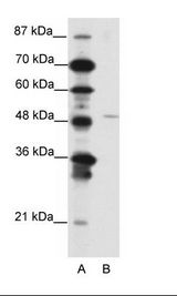 A: Marker, B: Jurkat Cell Lysate
