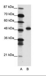 A: Marker, B: Jurkat Cell Lysate