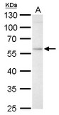 GBA antibody detects GBA protein by Western blot analysis. A. 30 ug HepG2 whole cell lysate/extract. 10 % SDS-PAGE. GBA antibody dilution:1:1000