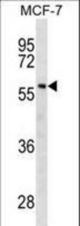 GC Antibody western blot of MCF-7 cell line lysates (35 ug/lane). The GC antibody detected the GC protein (arrow).