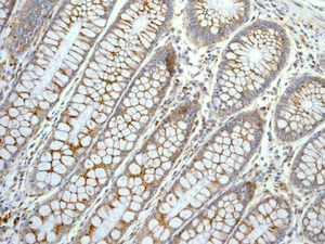IHC of paraffin-embedded human colon tissue using anti-Glucosylceramidase antibody.