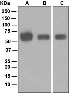 Western blot analysis on (A) Saos-2, (B) MCF-7, and (C) SH-SY5Y cell lysates using anti-Glucosylceramidase antibody.
