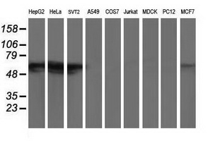 Western blot of extracts (35 ug) from 9 different cell lines by using anti-GBA3 monoclonal antibody.