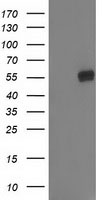 HEK293T cells were transfected with the pCMV6-ENTRY control (Left lane) or pCMV6-ENTRY GBA3 (Right lane) cDNA for 48 hrs and lysed. Equivalent amounts of cell lysates (5 ug per lane) were separated by SDS-PAGE and immunoblotted with anti-GBA3.