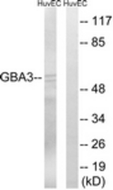 Western blot of extracts from HUVEC cells, using GBA3 Antibody. The lane on the right is treated with the synthesized peptide.