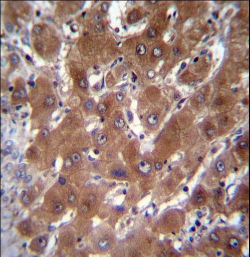 GBA3 Antibody immunohistochemistry of formalin-fixed and paraffin-embedded human liver tissue followed by peroxidase-conjugated secondary antibody and DAB staining.