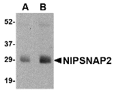 Western blot of NIPSNAP2 in human skeletal muscle tissue lysate with NIPSNAP2 antibody at (A) 0.5 and (B) 1 ug/ml