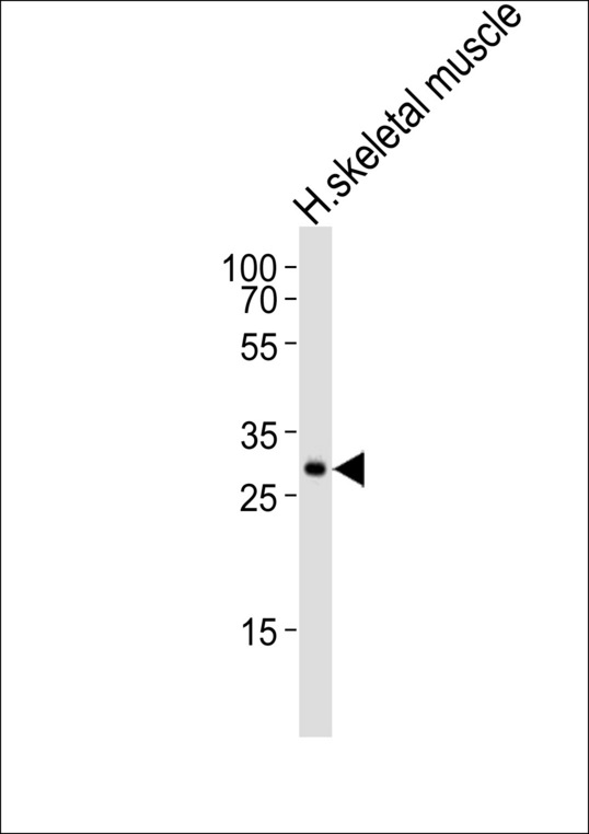 Western blot of lysate from human skeletal muscle tissue lysate with GBAS Antibody. Antibody was diluted at 1:1000. A goat anti-rabbit IgG H&L (HRP) at 1:10000 dilution was used as the secondary antibody. Lysate at 35 ug.