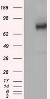 HEK293T cells were transfected with the pCMV6-ENTRY control (Left lane) or pCMV6-ENTRY GBE1 (Right lane) cDNA for 48 hrs and lysed. Equivalent amounts of cell lysates (5 ug per lane) were separated by SDS-PAGE and immunoblotted with anti-GBE1.