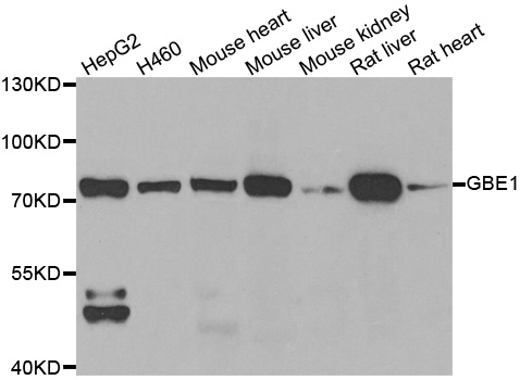 Western blot analysis of extracts of various cell lines, using GBE1 antibody.