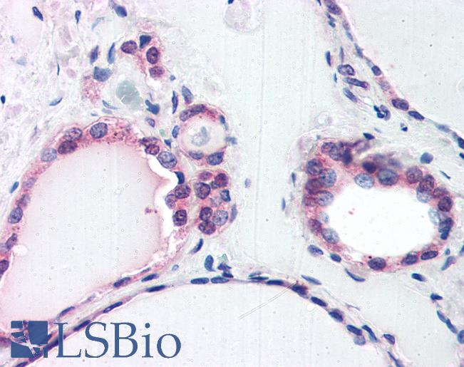 Anti-COPS2 antibody IHC of human thyroid. Immunohistochemistry of formalin-fixed, paraffin-embedded tissue after heat-induced antigen retrieval. Antibody LS-B2751 concentration 75 ug/ml.