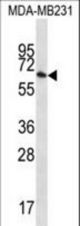 GBP1 Antibody western blot of MDA-MB231 cell line lysates (35 ug/lane). The GBP1 antibody detected the GBP1 protein (arrow).