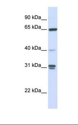 721_B cell lysate. Antibody concentration: 1.0 ug/ml. Gel concentration: 12%.