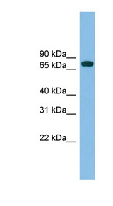 GBP2 antibody LS-C116589 Western blot of Fetal Liver lysate.