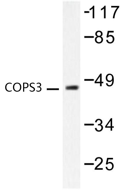 Western blot of COPS3 (M408) pAb in extracts from LOVO cells.
