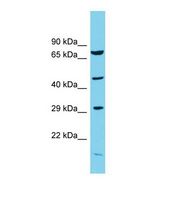 Western blot of Human Rat Testis . Cops3 antibody dilution 1.0 ug/ml.