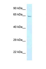 GBP3 antibody LS-C145731 Western blot of Placenta lysate. Antibody concentration 1 ug/ml.
