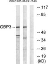 Western blot of extracts from HT-29/COLO cells, using GBP3 Antibody. The lane on the right is treated with the synthesized peptide.