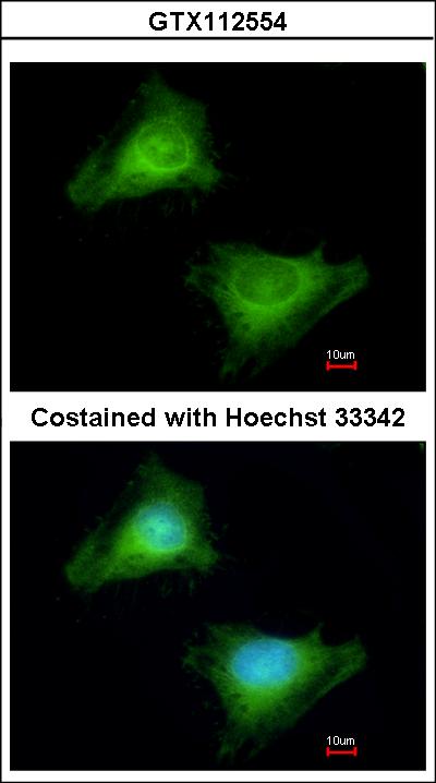 Immunofluorescence of methanol-fixed HeLa using Guanylate binding protein 3 antibody at 1:200 dilution.