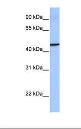 Placenta cell lysate. Antibody concentration: 1.0 ug/ml. Gel concentration: 12%.