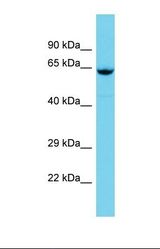 Western blot of Human Lymph Node Tumor. GBP5 antibody dilution 1.0 ug/ml.
