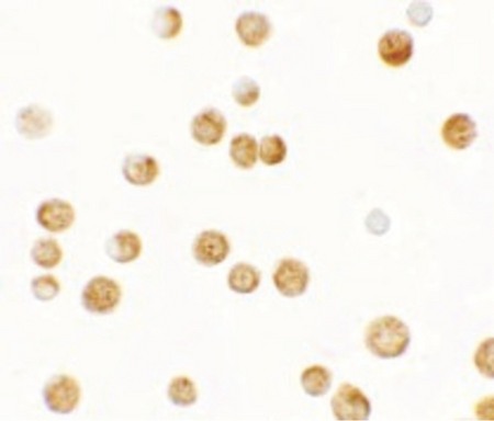 Immunocytochemistry of GBP6 in HeLa cells with GBP6 antibody at 2.5 ug/ml.