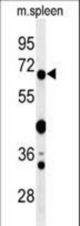 Western blot of GBP7 Antibody in mouse spleen tissue lysates (35 ug/lane). GBP7 (arrow) was detected using the purified antibody.