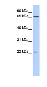 DIRAS1 antibody LS-C102473 Western blot of 293T cell lysate.