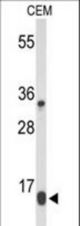Western blot of DIRAS1 Antibody in CEM cell line lysates (35 ug/lane). DIRAS1 (arrow) was detected using the purified antibody.