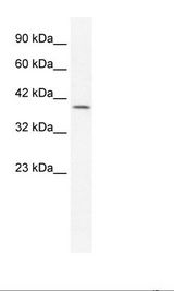 Jurkat Cell Lysate